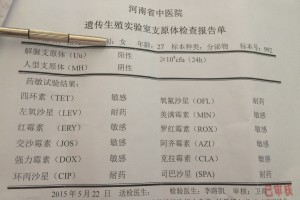 真实案例｜事前检测阴性发生无保护行为后,检测结果为“待复查”!_百度...