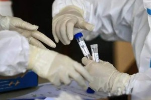 北京十混一阳性最新政策︰(北京混检阳性)