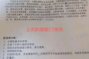 上海医院现疑似病例,上海医院现疑似病例新闻发布会