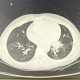 【广州南沙区发现13名核酸阳性/广州市南沙区确诊新型肺炎】