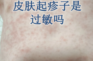 南京新增1例无症状感染者.南京新增5例