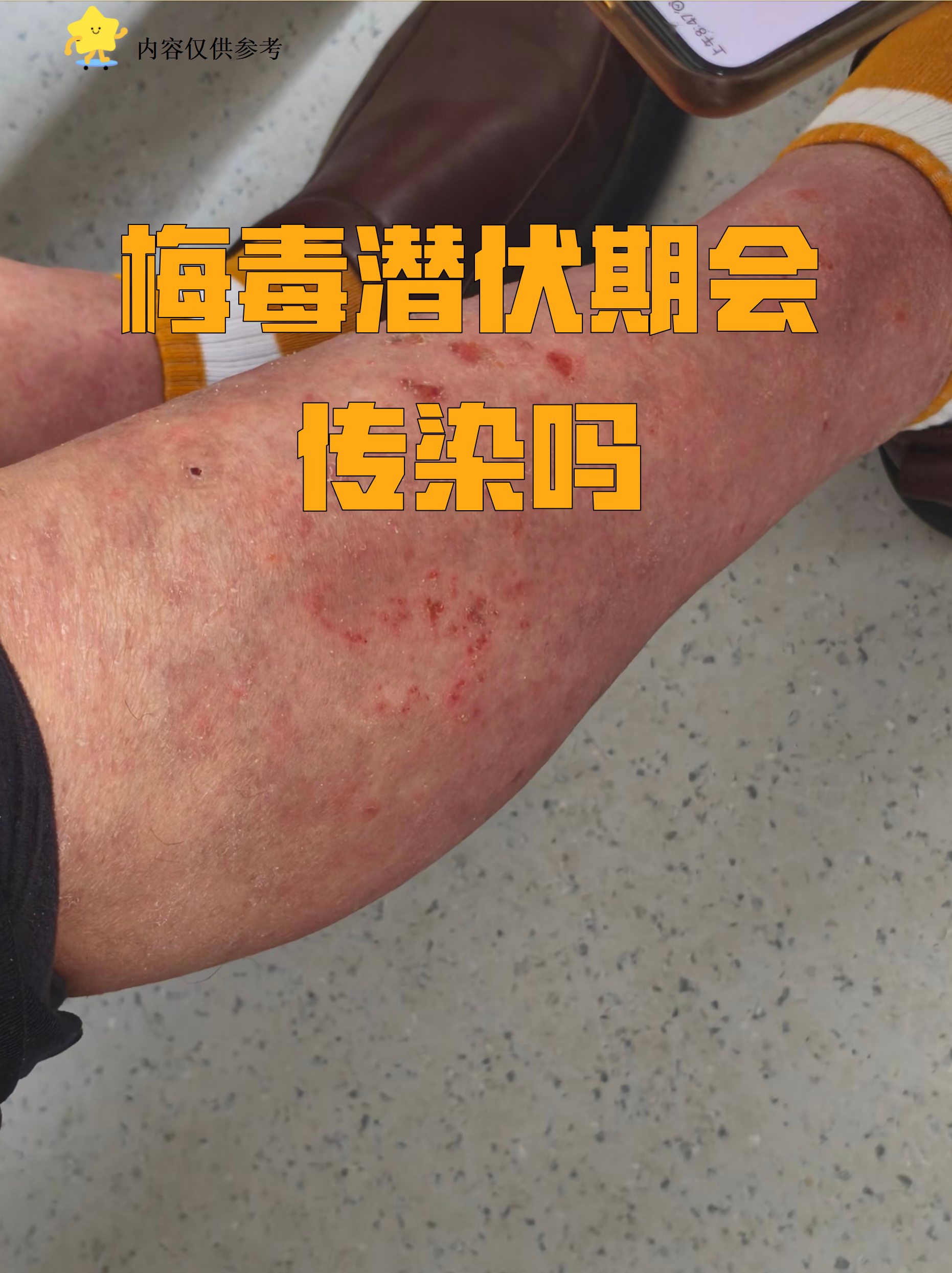 「南京新增1例无症状感染者」〃南京新增一例无症状感染者-第3张图片