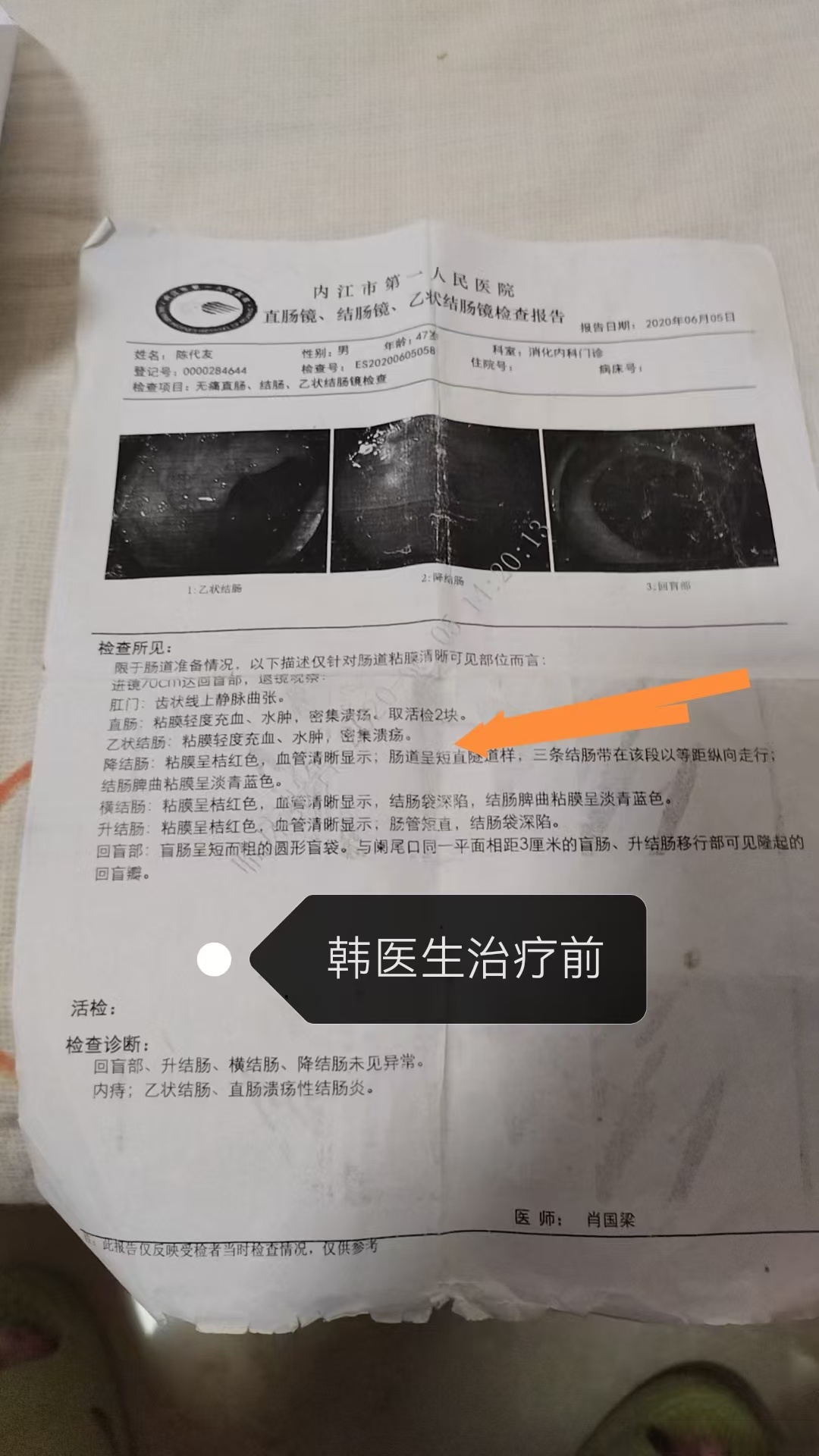 贵州新增确诊病例1例-贵州新增1例疑似病例-第1张图片