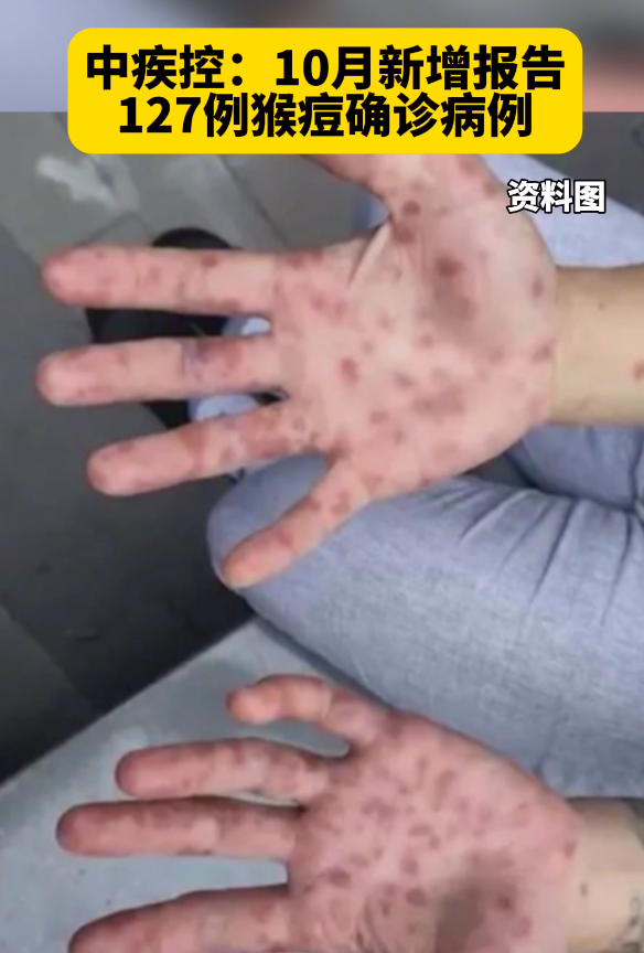 河北省疫情︰(6月16日河北省疫情)-第1张图片