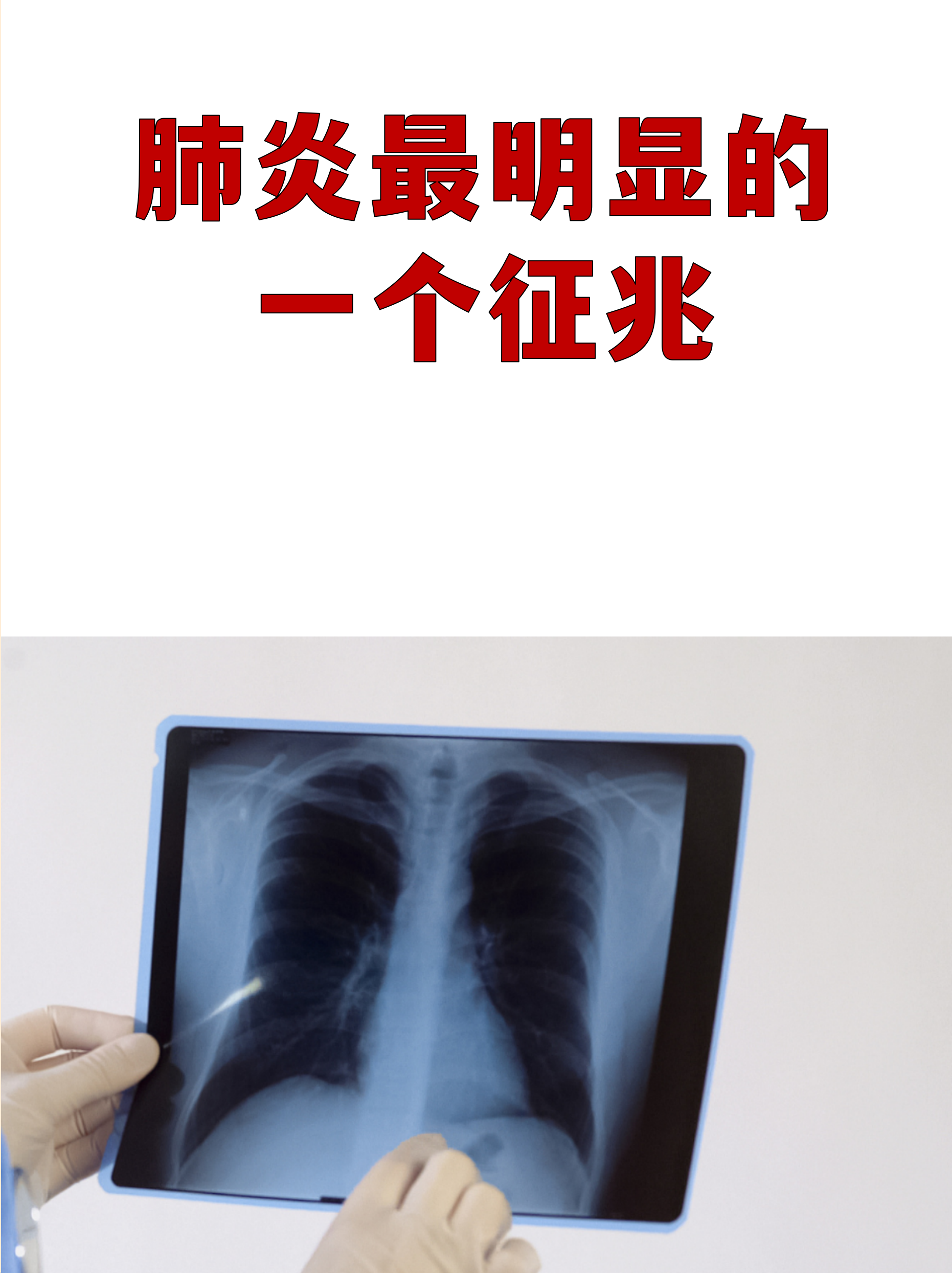 【新疆新增4例无症状感染者/新疆新增确诊22例 无症状感染者38例】-第1张图片