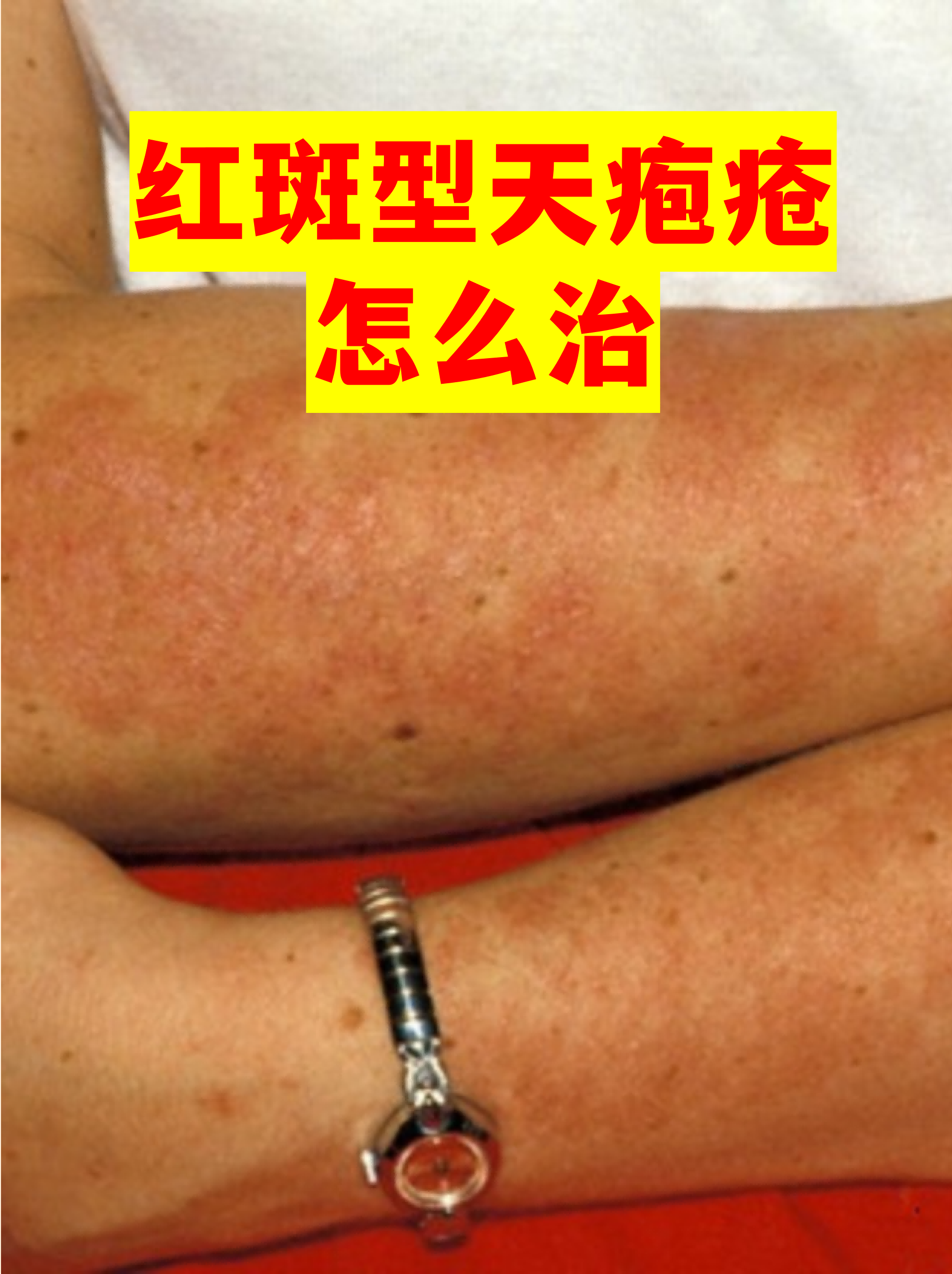 “四川新增省内感染者30例	” 四川新增感染者的症状？-第1张图片