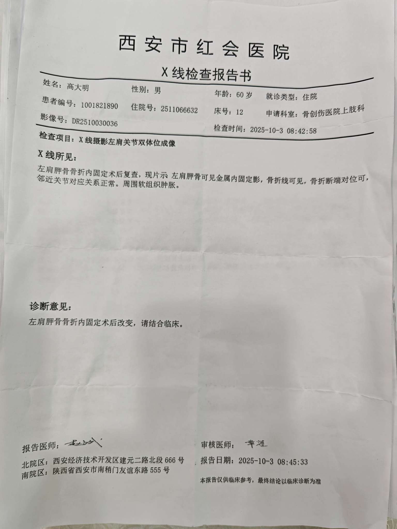 西安新增1例本土-西安新增一例确诊病例-第2张图片
