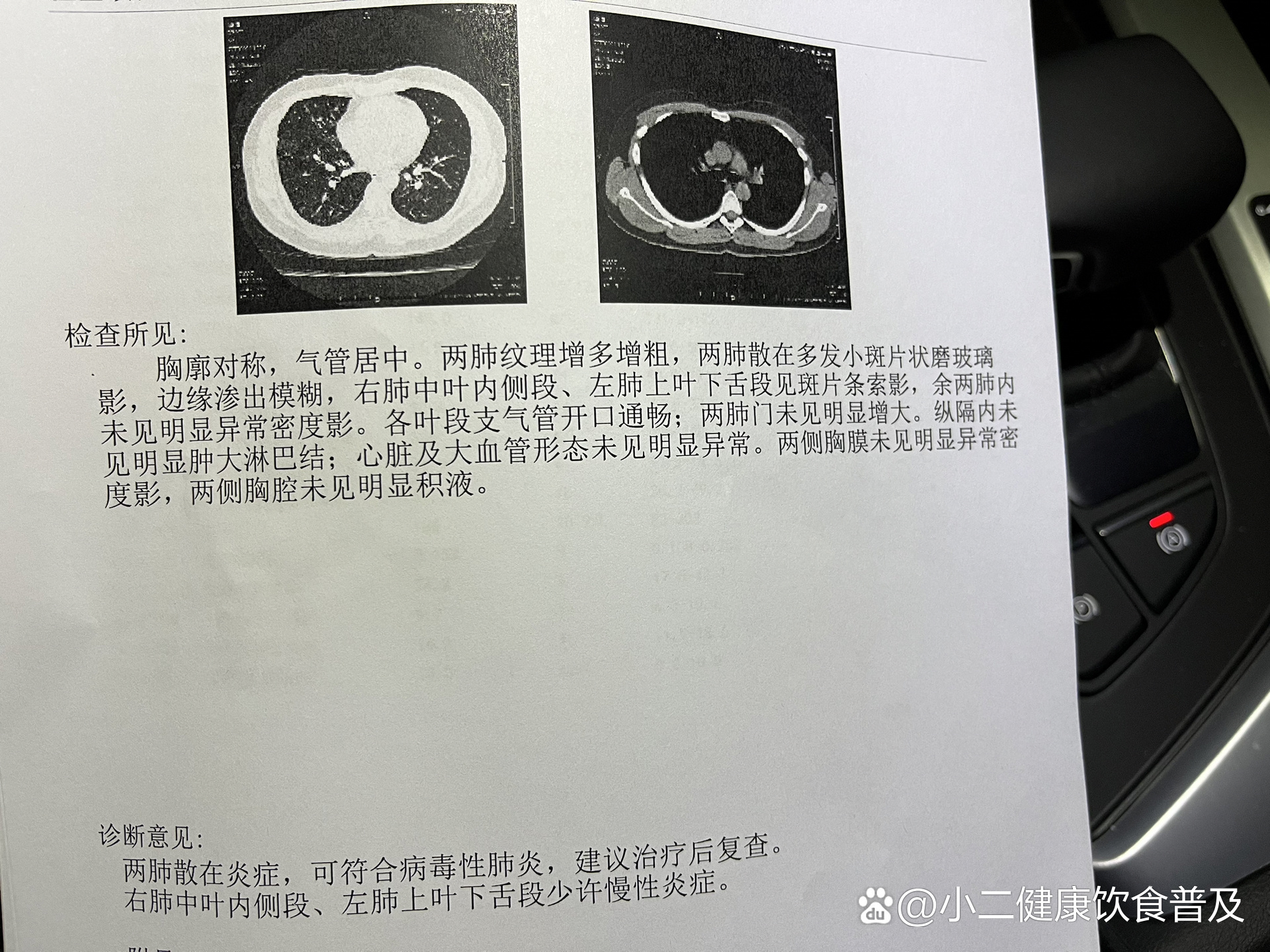「丰台新增1例境外输入」〃丰台出现一例新型肺炎-第1张图片