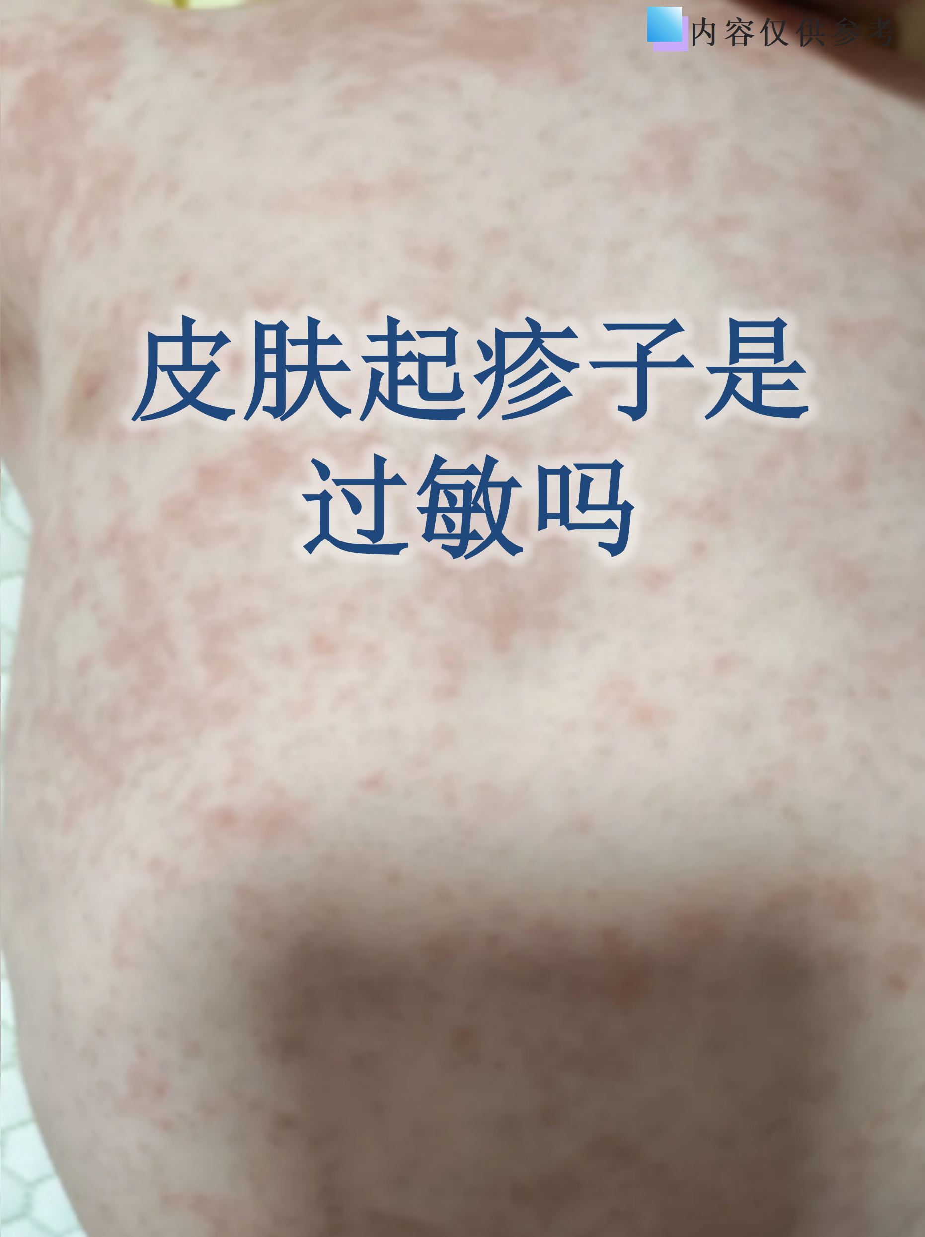 南京新增1例无症状感染者.南京新增5例-第1张图片