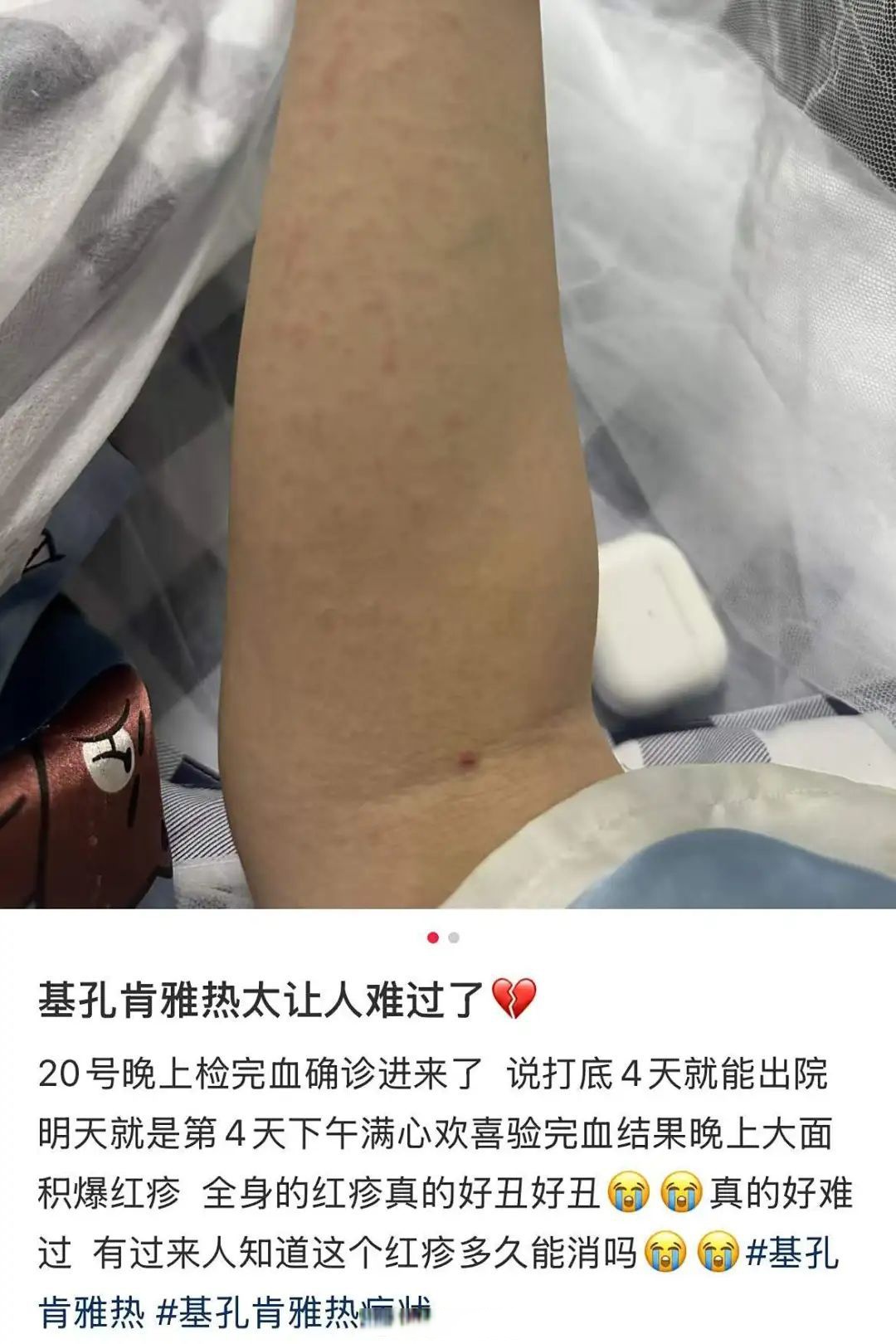 “31个省份新增确诊病例17例	” 31个省新增确诊病例30例？-第1张图片