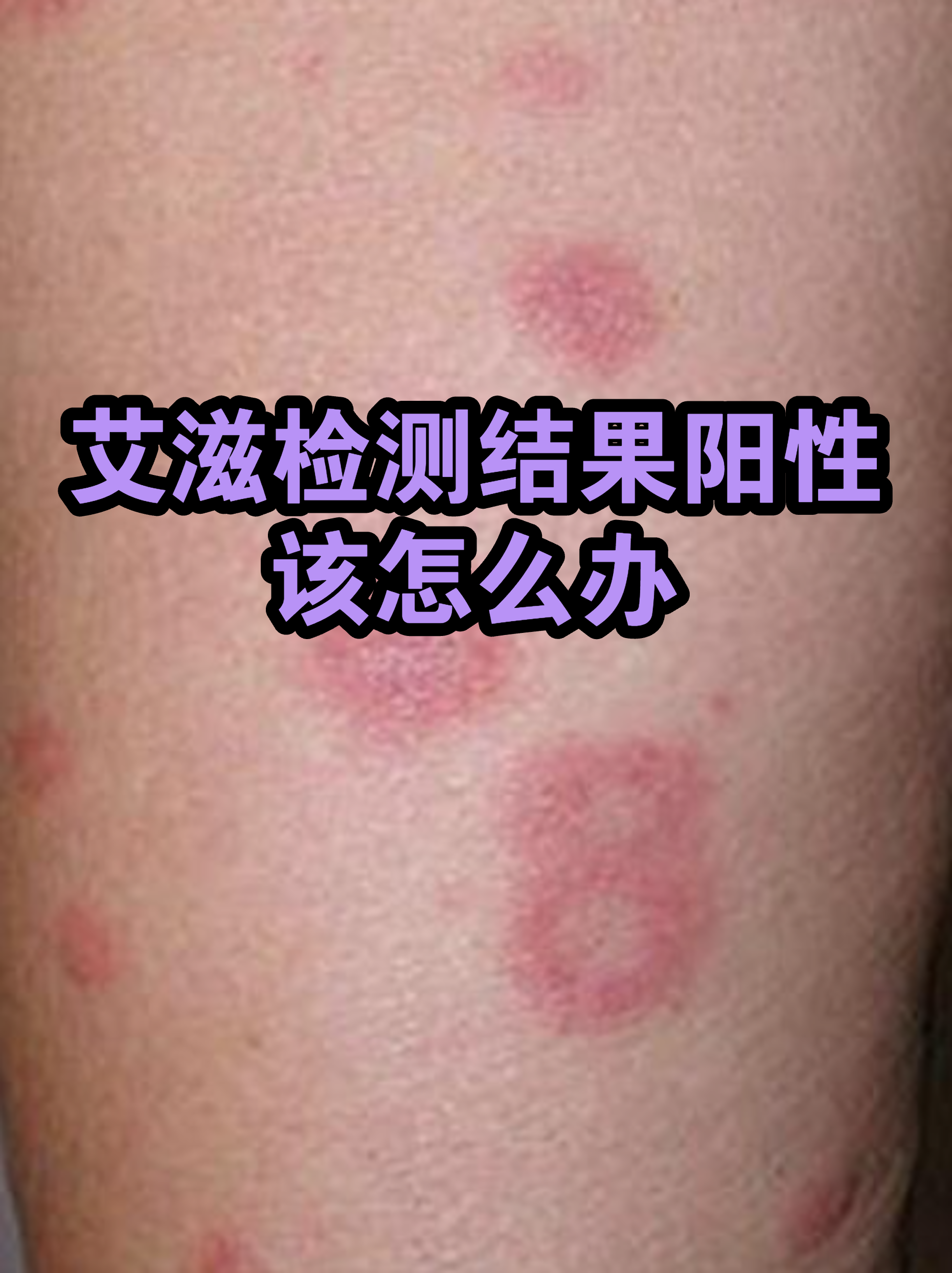 “江苏无锡发现31名阳性人员” 无锡确诊阳性？-第1张图片